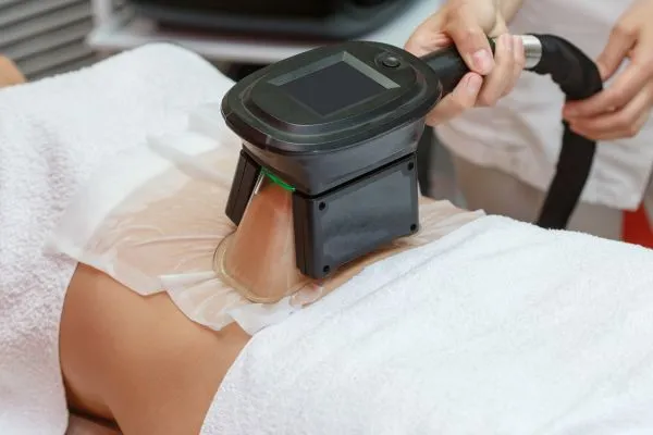 Image of person having fat freezing treatment to help weight gain Billericay