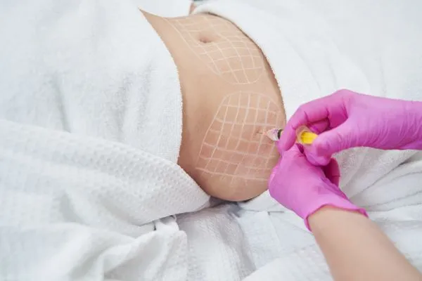 image of fat dissolving injections on love handles to help combat weight gain Billericay