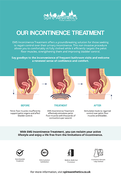 image of how urge incontinence Billericay treatment works