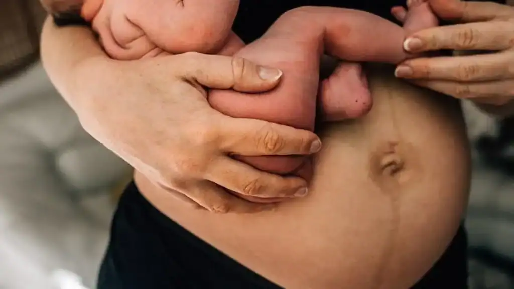 Why Is My Stomach Still Big After Pregnancy Billericay?